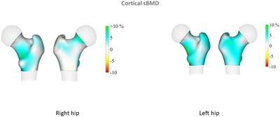 Areal bone mineral density, trabecular bone score and 3D-DXA analysis of proximal femur in psoriatic disease